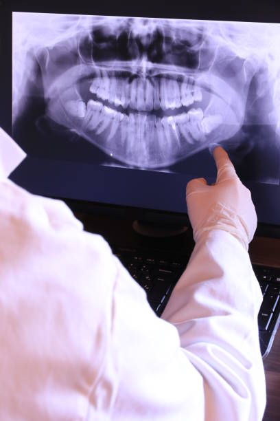 Best Emergency Dental Care for Abscessed Tooth in Clayton, NC